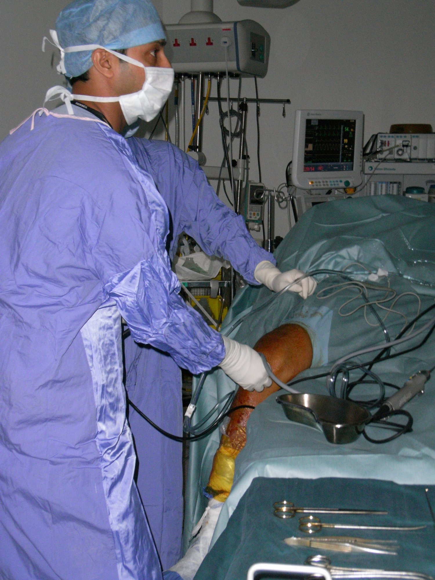 Arthroscopic surgery